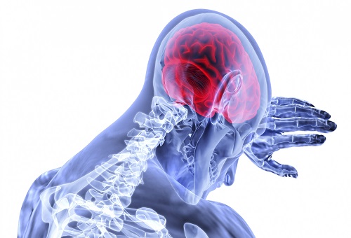 3D biopsies to better understand brain tumours