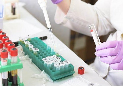 Krsnaa Diagnostics surges on securing tender to establish & operate laboratory setup in Odisha