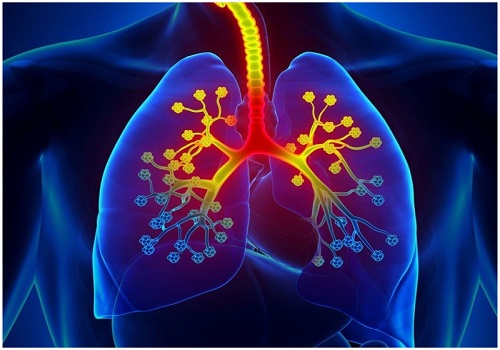 Inflammatory protein potential key to treating severe asthma