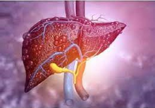 AI offers promise for earlier & accurate liver cancer diagnosis