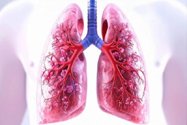 Chest X-rays inadequate to detect asymptomatic TB among household contacts: The Lancet