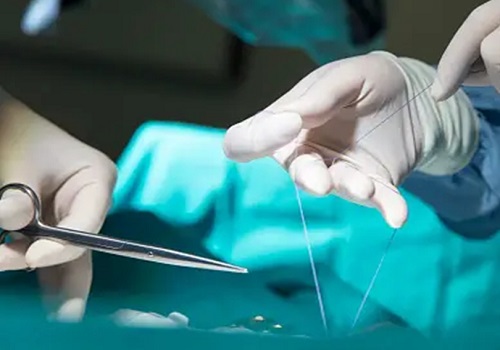 India surgical sutures market to grow to $380 mn in 2030	